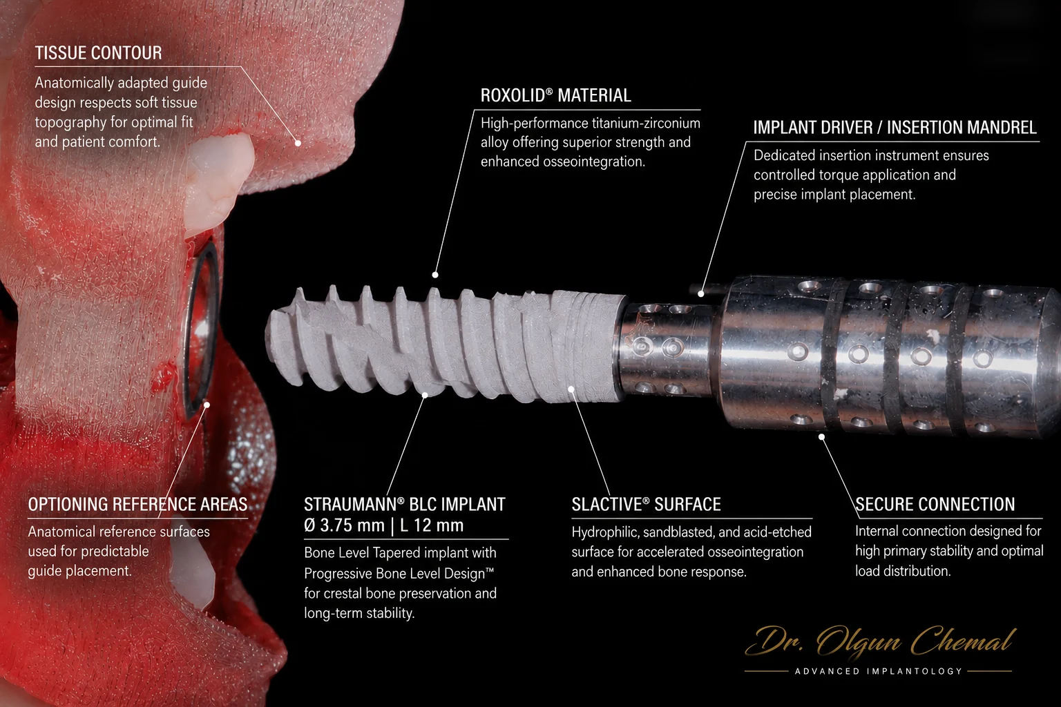Implant Straumann BLC Roxolid SLActive montat pe mandrenul de inserare, lângă ghidul chirurgical
