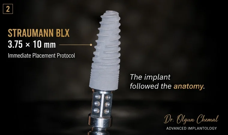 Implant Straumann BLX 3.75 x 10 mm, detaliu